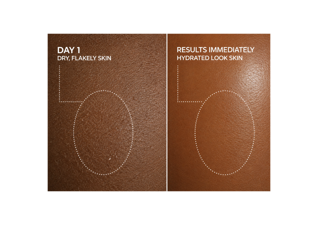 KB Cellulite & Stretch Mark Combo