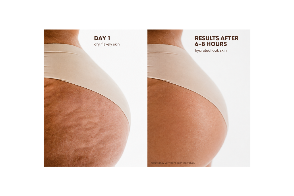 KB Stretchmark Oil
