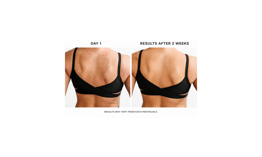KB Bump & Glow Set