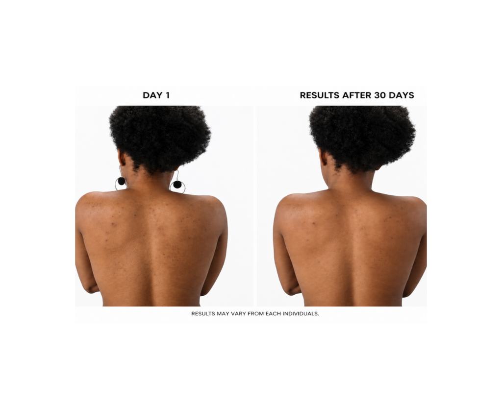 KB Bump & Glow Set